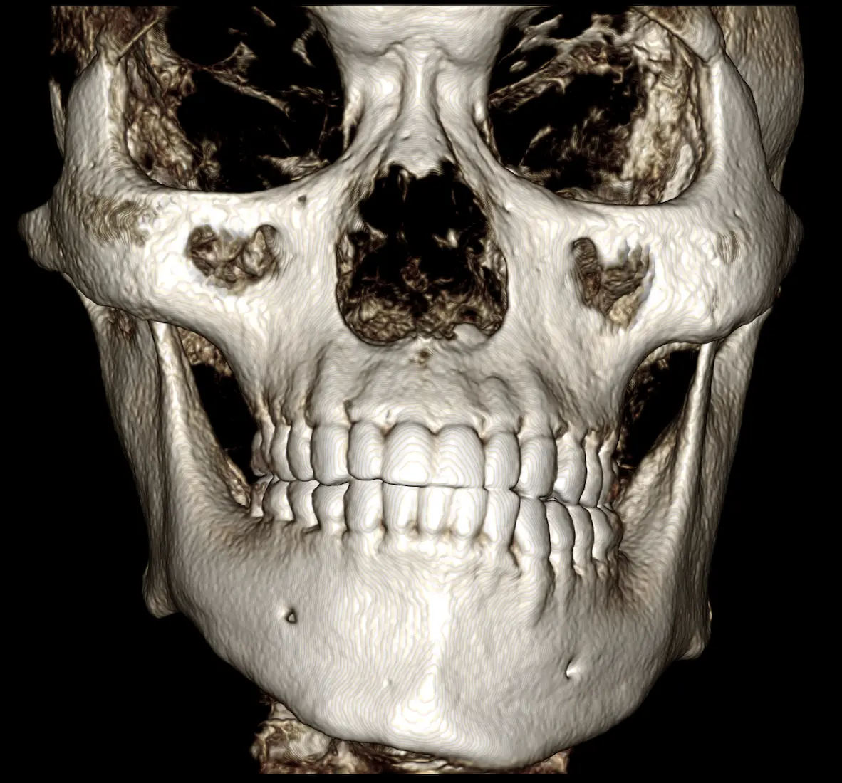 Orthognathic Surgery Overview Image