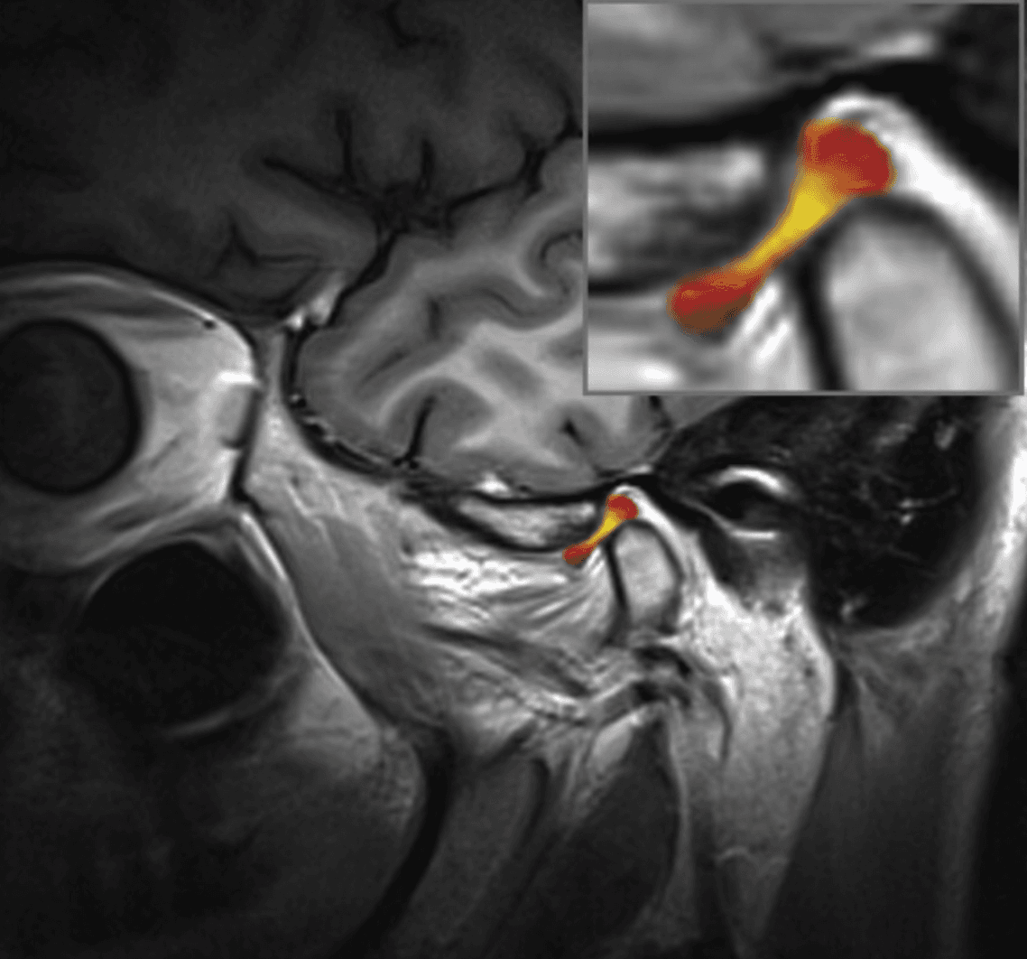 TMJ Disorders Treatment Image