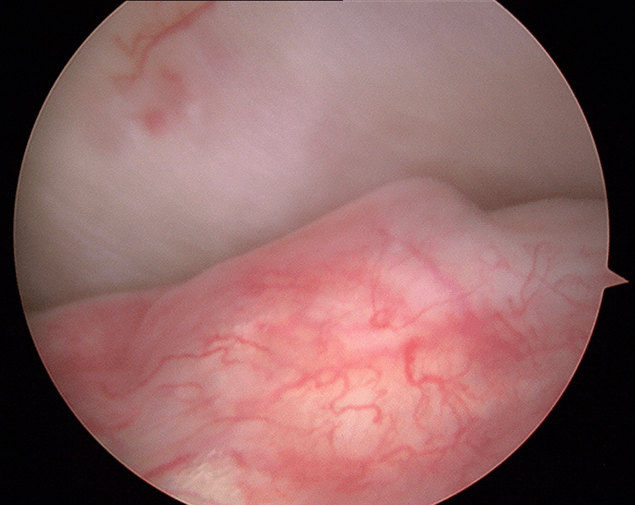 TMJ Disorders Treatment Image 2