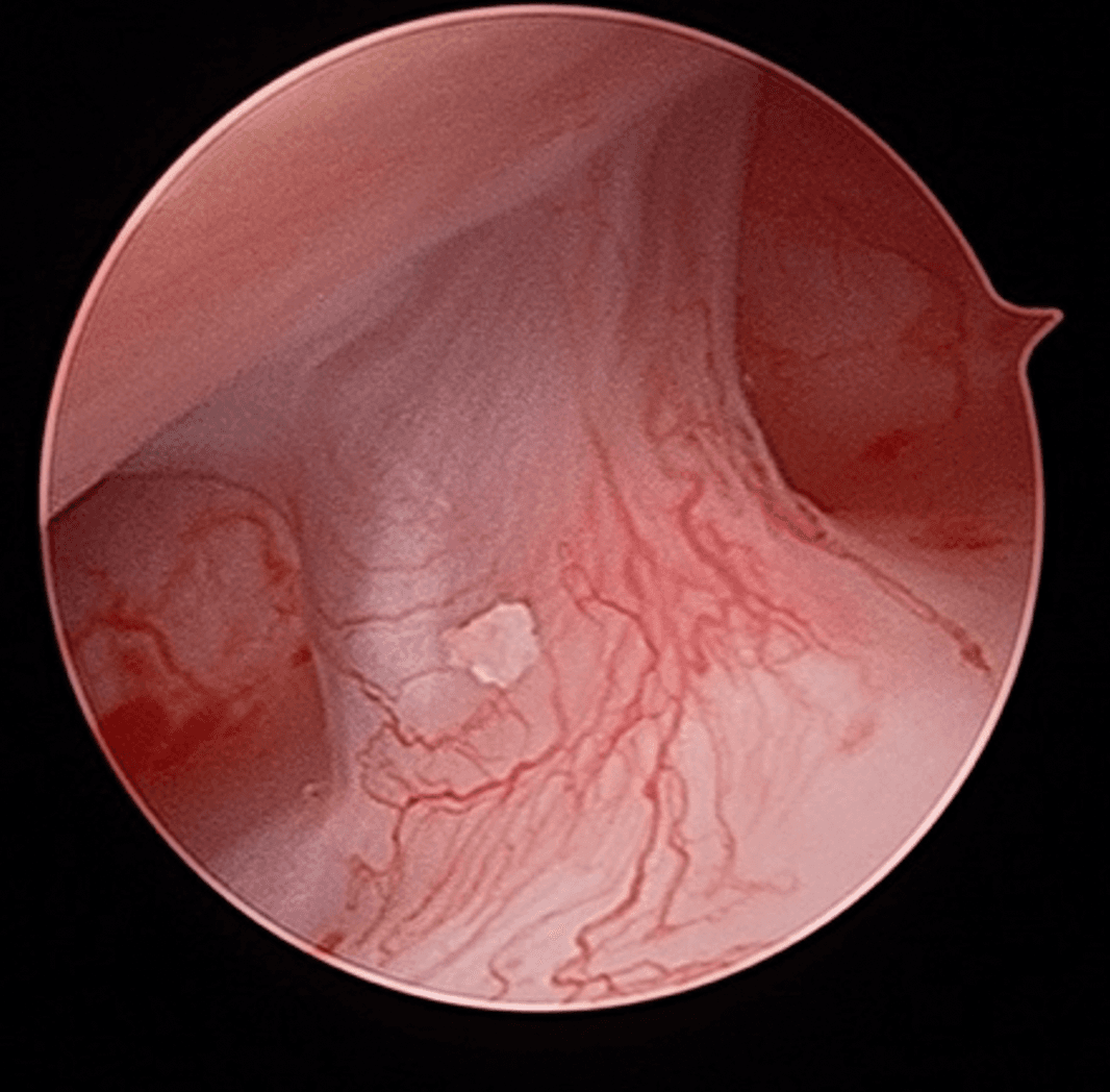 TMJ Disorders Treatment Image 3