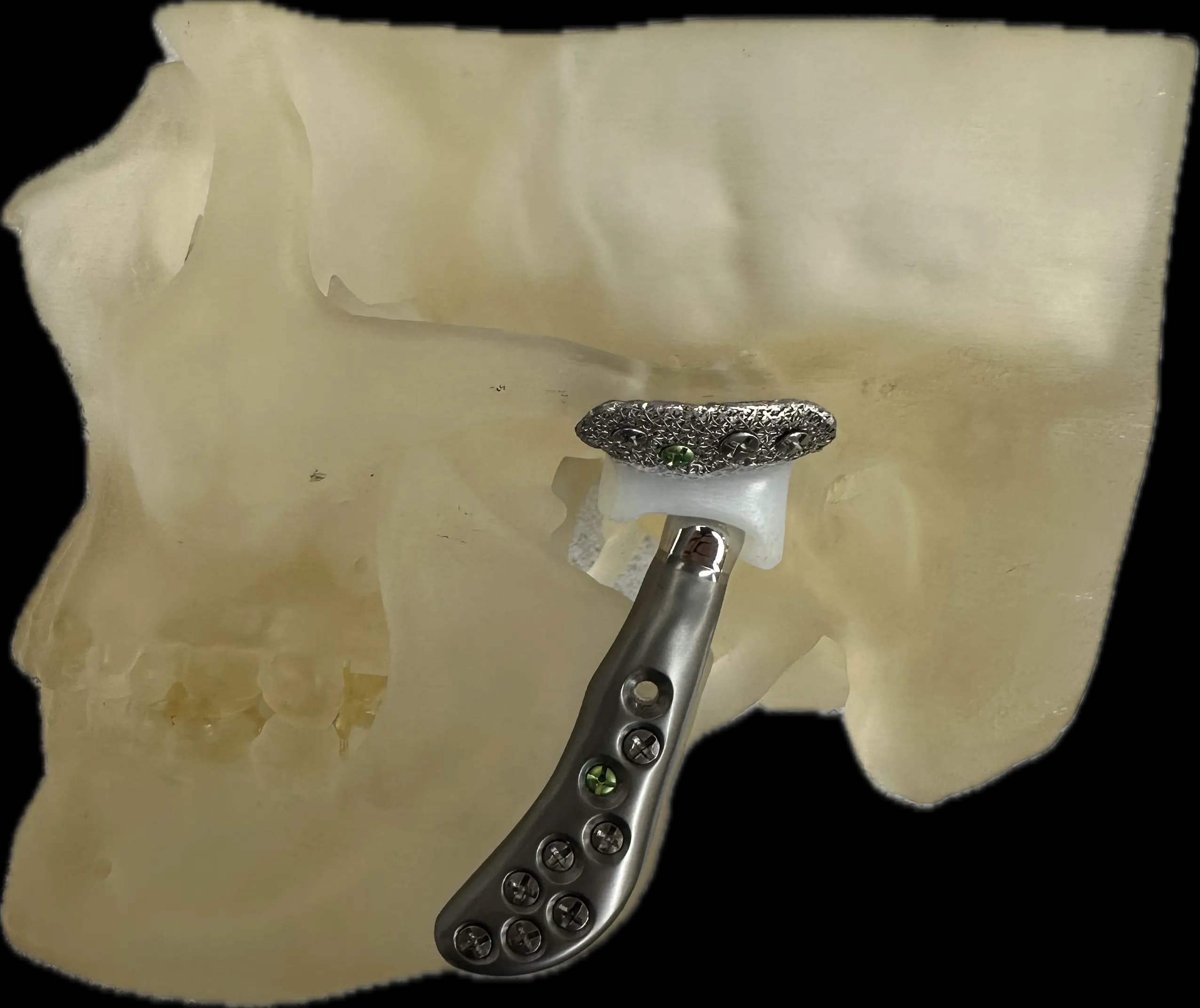 TMJ Disorders Treatment Image 6